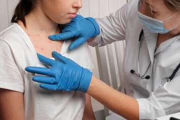 Doctor treating child who has measles (Image by Marina Demidiuk / iStock / Getty Images Plus via Getty Images)